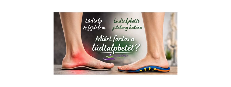 Mi a lúdtalp és miért fontos a lúdtalpbetét?