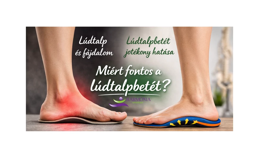 Mi a lúdtalp és miért fontos a lúdtalpbetét?